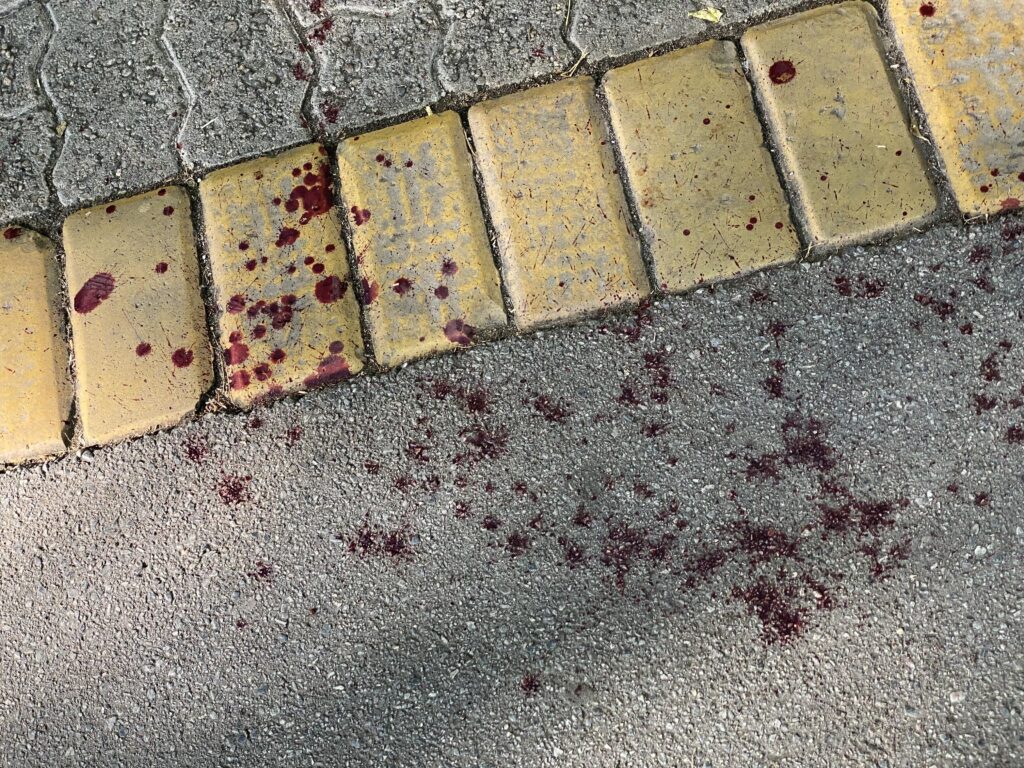 Subotičanin nožem napao i povredio Tunižanina u centru grada